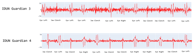 Caption: Two recordings in identical experimental conditions; notice the higher SNR on the IDUN Guardian 4 (bottom) than the IDUN Guardian 3 (top)