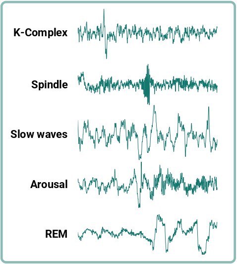 sleep microarchitecture as measured by one-channel in-ear EEG earbuds